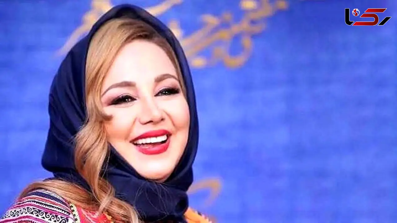 چهره بهنوش بختیاری زمین تا آسمان فرق کرد ! + عکس عمل های عروسکی 