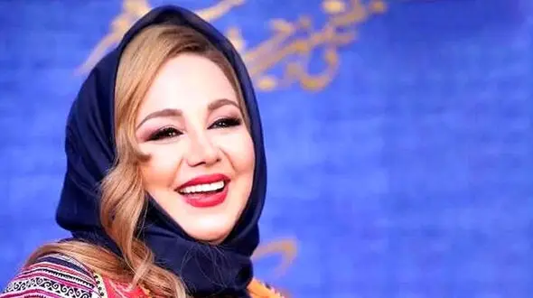 چهره بهنوش بختیاری زمین تا آسمان فرق کرد ! + عکس عمل های عروسکی 