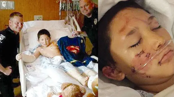 مبارزه پسر 9 ساله  با سگ وحشی برای نجات جان بچه‌ها در پارک + عکس