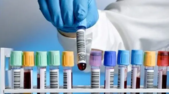 شناسایی سرطان تا ۳ سال پیش از بروز علائم با آزمایش خون جدید!