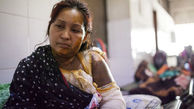 اسیدپاشی مرد بنگلادشی به همسرش