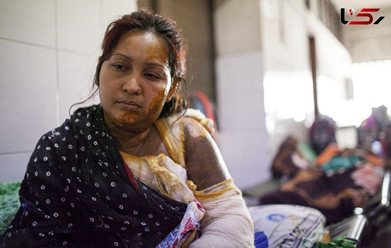 اسیدپاشی مرد بنگلادشی به همسرش