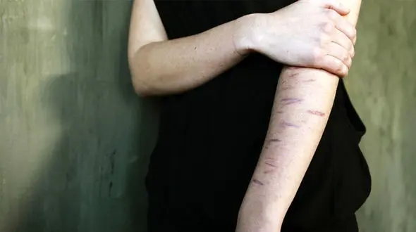 خودزنی ۲۸۹ همدانی برای دریافت دیه