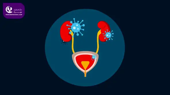 دلایل بروز عفونت مثانه در زنان + درمان صحیح و نکات مراقبتی
