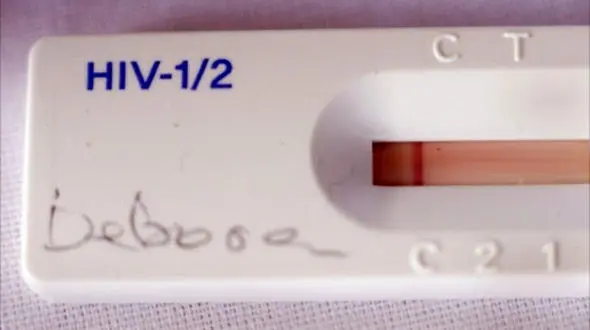 
کیت تشخیص ایدز در داروخانه ها عرضه می شود
