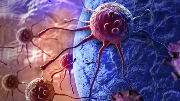 علائم سرطان سینه در زنان