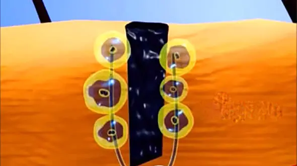 وقتی خالکوبی می کنید واقعا چه اتفاقی می افتد؟ + فیلم