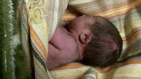 بازگشت از مرگ نوزاد 10 روزه پس از 8 دقیقه