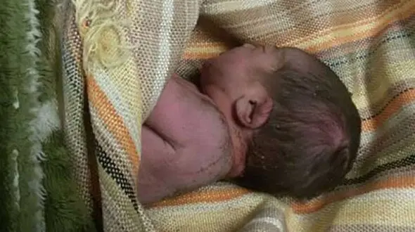 بازگشت از مرگ نوزاد 10 روزه پس از 8 دقیقه
