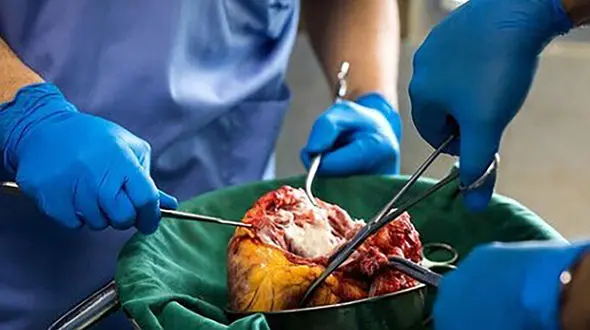 مرگ دلخراش محسن جلوی چشمان برادرش ! /  جوانی که فرشته شد + عکس