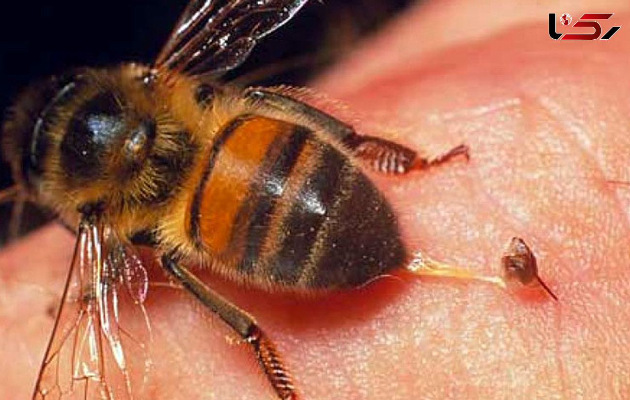 مرگ مرموز دختر 10 ساله با نیش زنبور