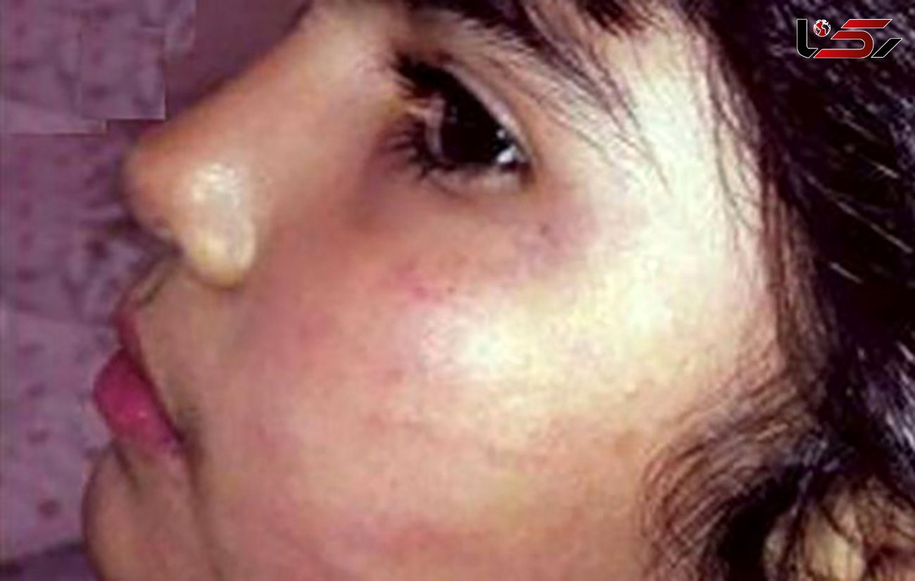 پرونده تخلف دندانپزشک به خاطر رفتار زشت با دختر 6 ساله بررسی می شود+عکس