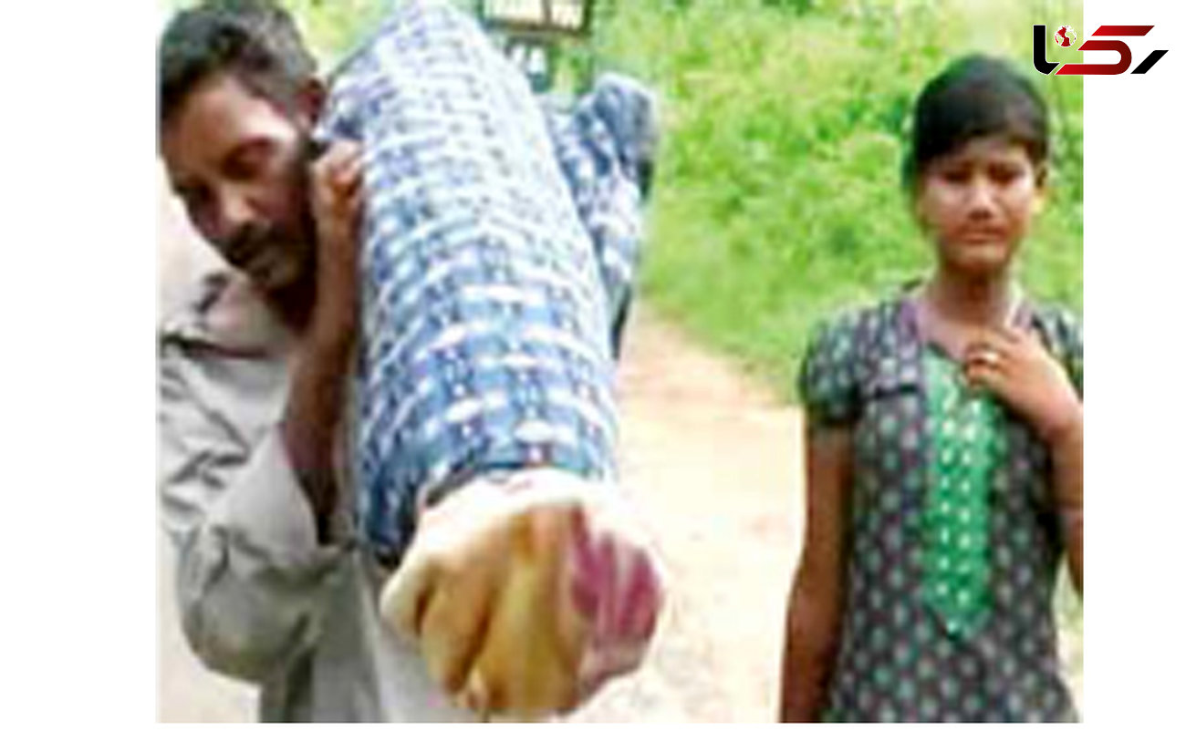 مرد فقیر جسد همسرش را روی دوش از بیمارستان شهر به روستا برد+عکس
