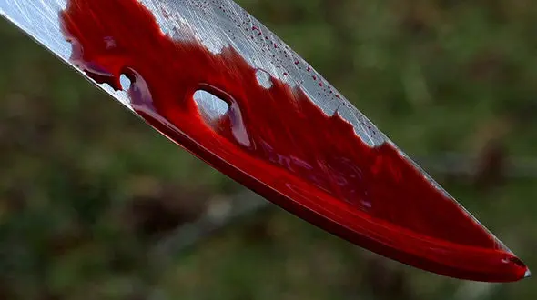 بریدن گلوی پسربچه آمریکایی توسط نامادری بی رحم + عکس