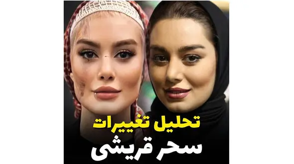تغییرات چهره سحر قریشی + فیلم تحلیل دقیق و جز به جز ! 