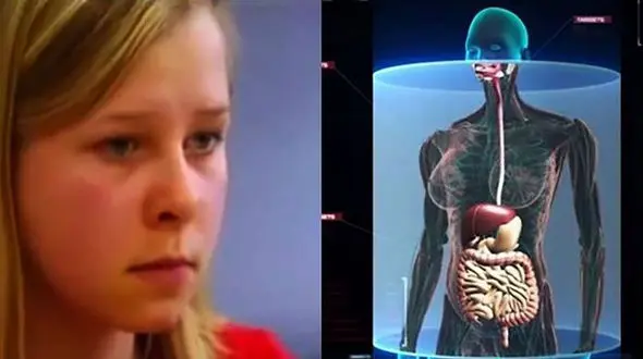 چشمان این دختر اعضای داخلی بدن انسان را می بیند + عکس