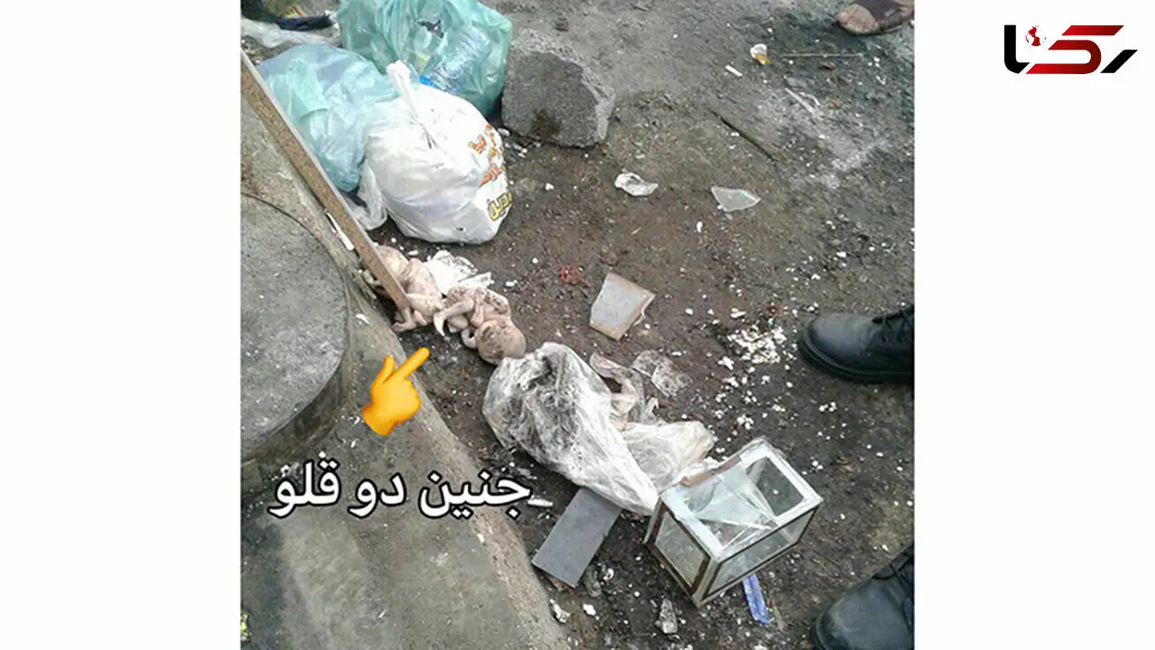 انتشار عکس  جنین 2 قلوها در زباله های رشت / خیلی تکاندهنده