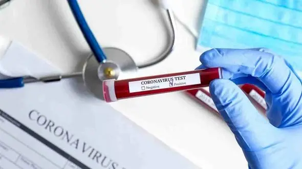 
رکوردهای کرونا هر ساعت جابجا می شود 