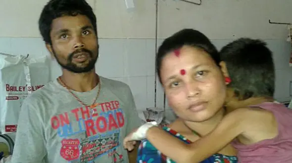 چشمان این کودک از حدقه بیرون زده است +عکس فجیع(+18)