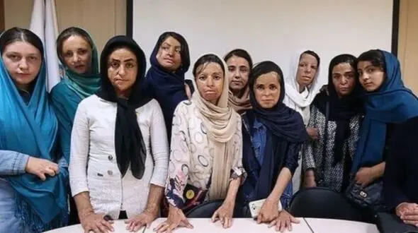 زنده شدن امیدها برای درمان دختران شین آبادی 