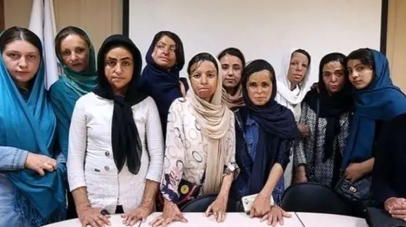 زنده شدن امیدها برای درمان دختران شین آبادی 