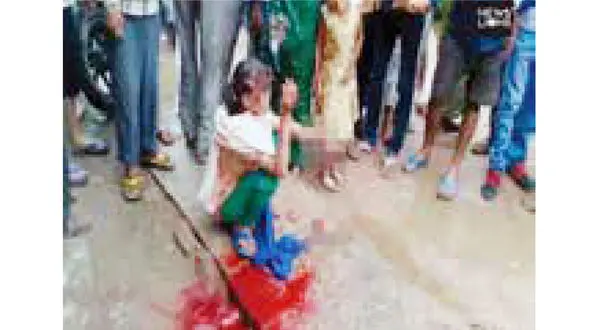 قطع دست دختر 15 ساله  به خاطر تلفن همراه در خیابان +عکس