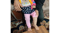 حمله وحشیانه  شغال به  یک کودک  10 ماهه همدانی / مادربزرگ ناجی او شد  + عکس 