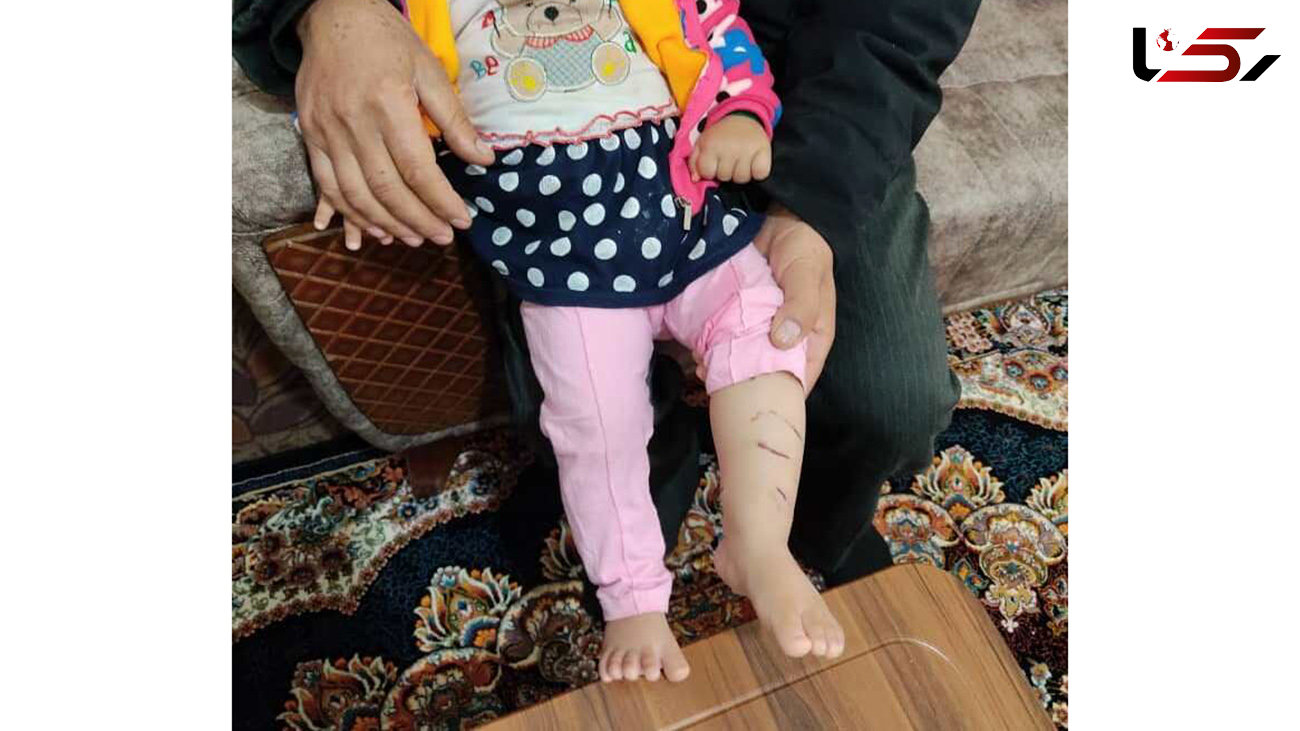 حمله وحشیانه  شغال به  یک کودک  10 ماهه همدانی / مادربزرگ ناجی او شد  + عکس 
