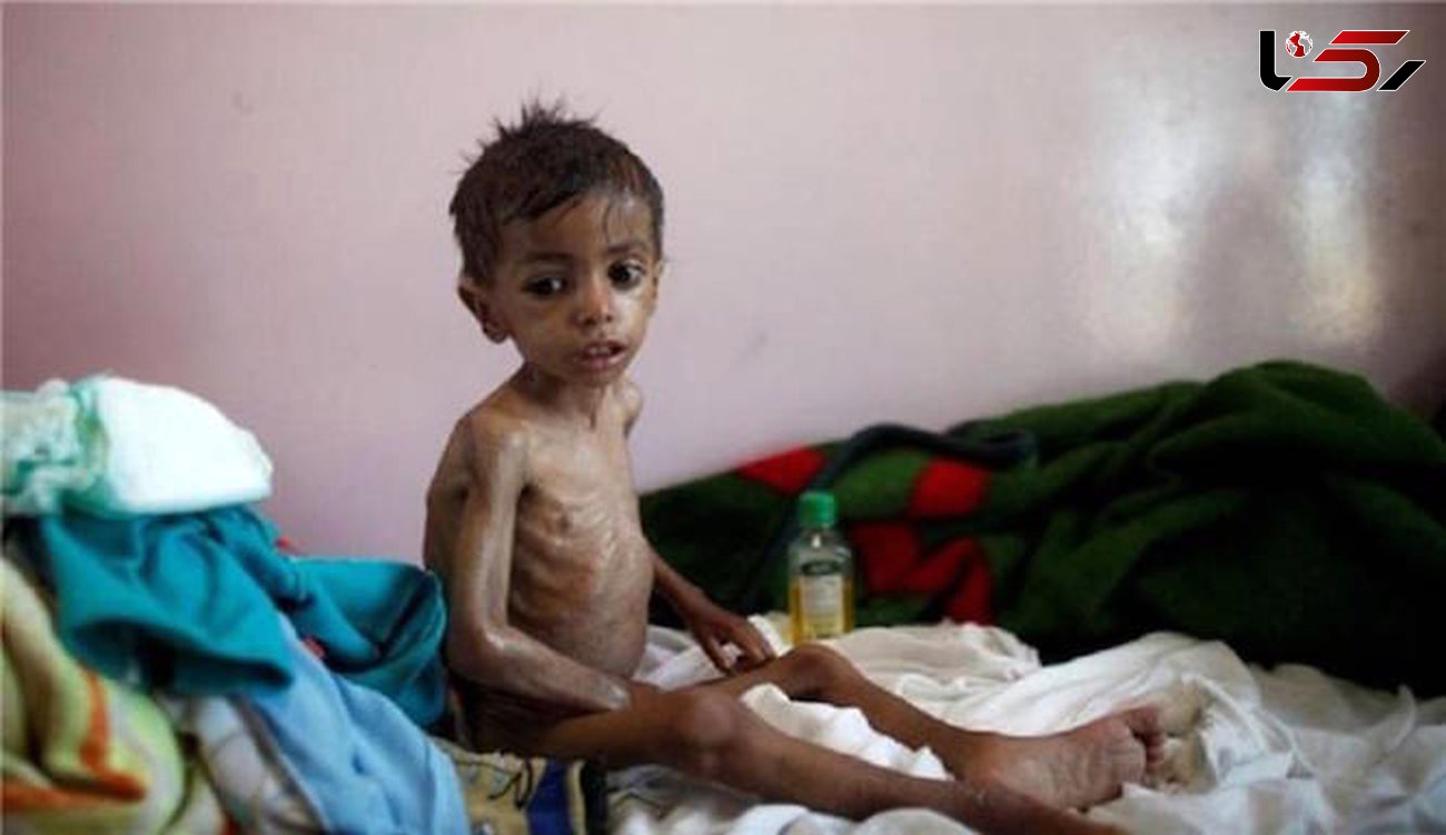 گرسنگی جان یمنی‌ها را تهدید می‌کند