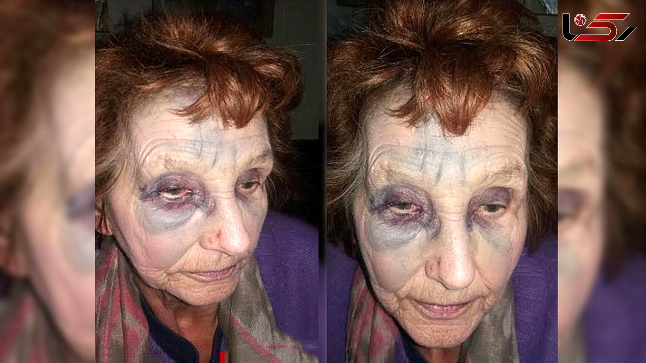 حمله وحشیانه به پیرزن 78 ساله در روز روشن +عکس