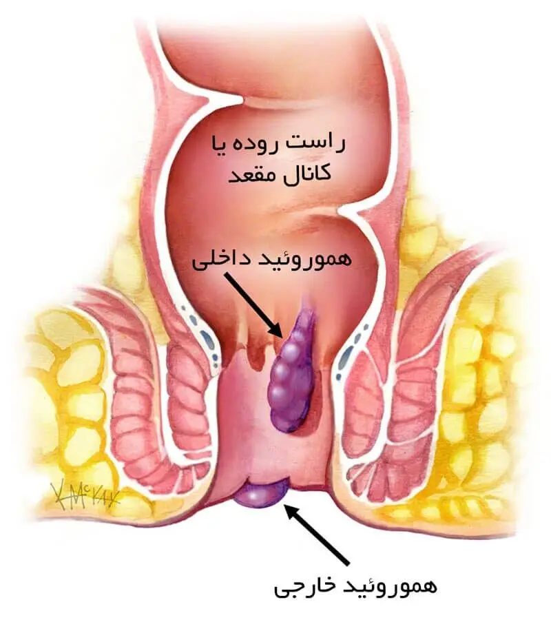 راست روده یا کانال مقعد