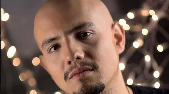 امیرکاظمی با موهای کم پشت و پوست سیاه