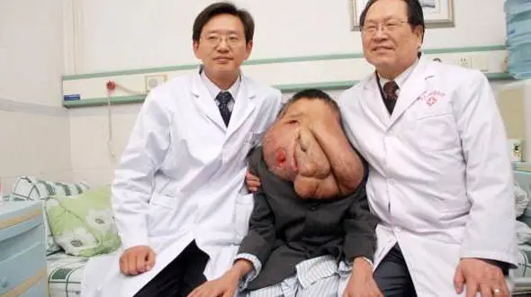 زشتترین مرد دنیا + عکس