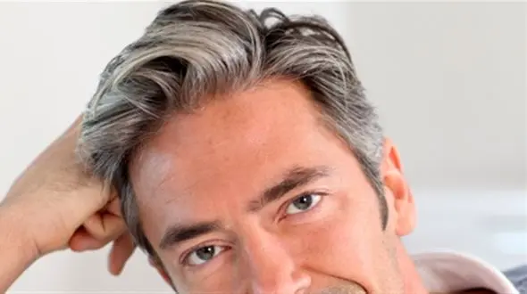 علت سفید شدن ناگهانی مو در جوانی و نوجوانی چیست؟