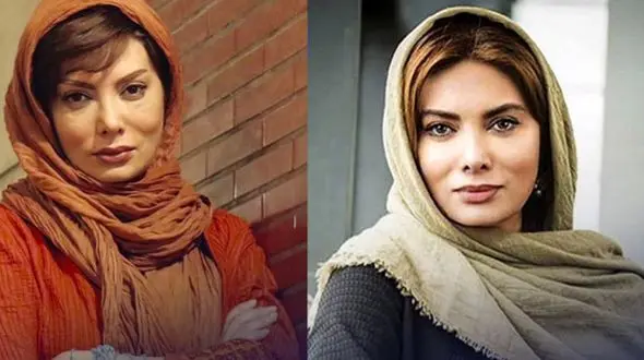 تغییر چهره خانم بازیگر «اخراجی‌ها» بعد از جراحی‌های شدید، رسانه‌ها را شگفت‌زده کرد / این نگار فروزنده نیست !