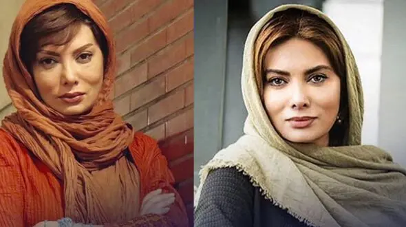 تغییر چهره خانم بازیگر «اخراجی‌ها» بعد از جراحی‌های شدید، رسانه‌ها را شگفت‌زده کرد / این نگار فروزنده نیست !