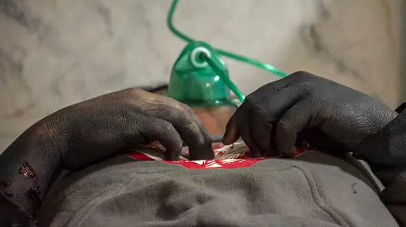 924 مصدوم در مراسم چهارشنبه سوری / بیشترین مصدومان در تهران