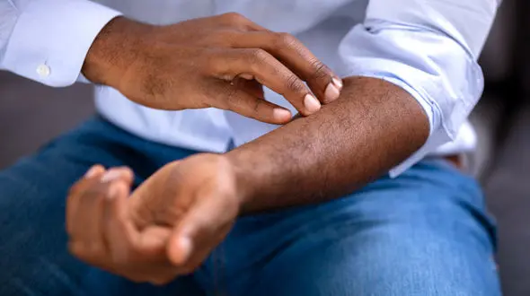 داروهایی که پوست  را خشک می کنند