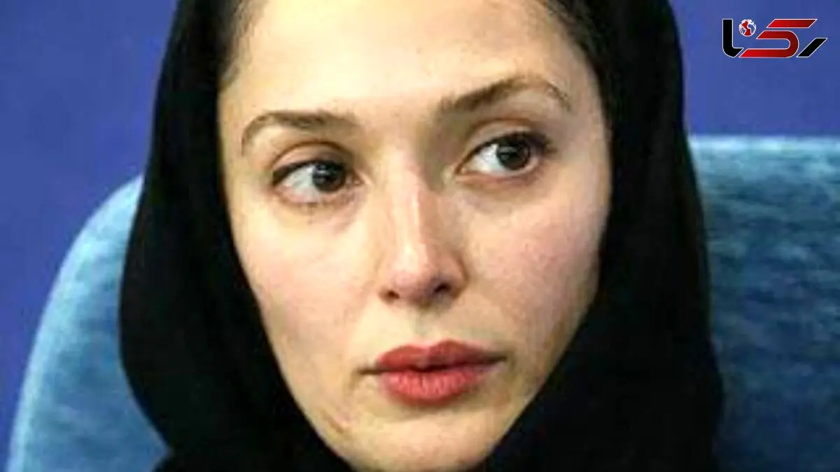 عکس دردرناک از تغییر چهره آتنه فقیه نصیری، بازیگر شمعدونی قبل و بعد از بیماری