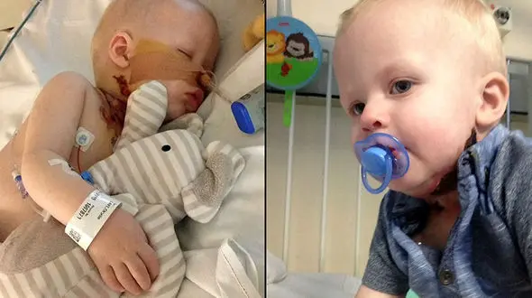 وحشتناک‌ترین باکتری جهان گردن این کودک را زنده زنده خورد+تصاویر (14+)