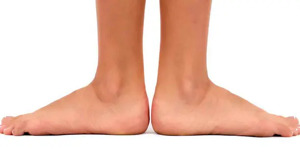 دو مشکل رایجی که در شکل پاها وجود دارد !