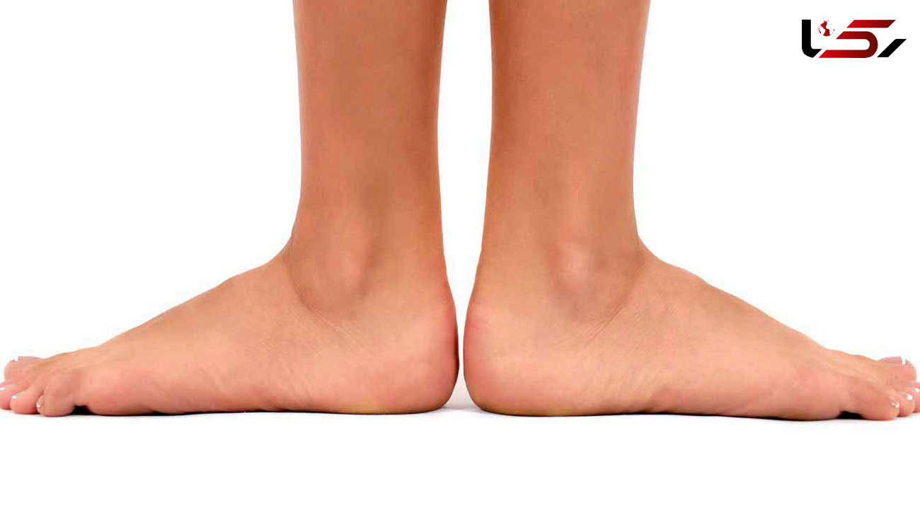 دو مشکل رایجی که در شکل پاها وجود دارد !