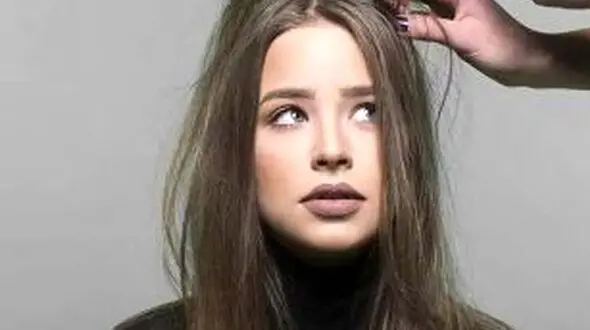 غلبه چربی موی سر در زمستان + دلایل و درمان