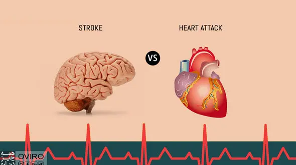 چه اشخاصی در خطر سکته هستند؟