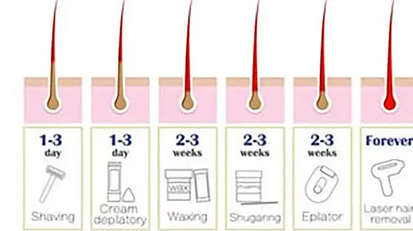 راه های از بین بردن دائمی موهای زائد در منزل