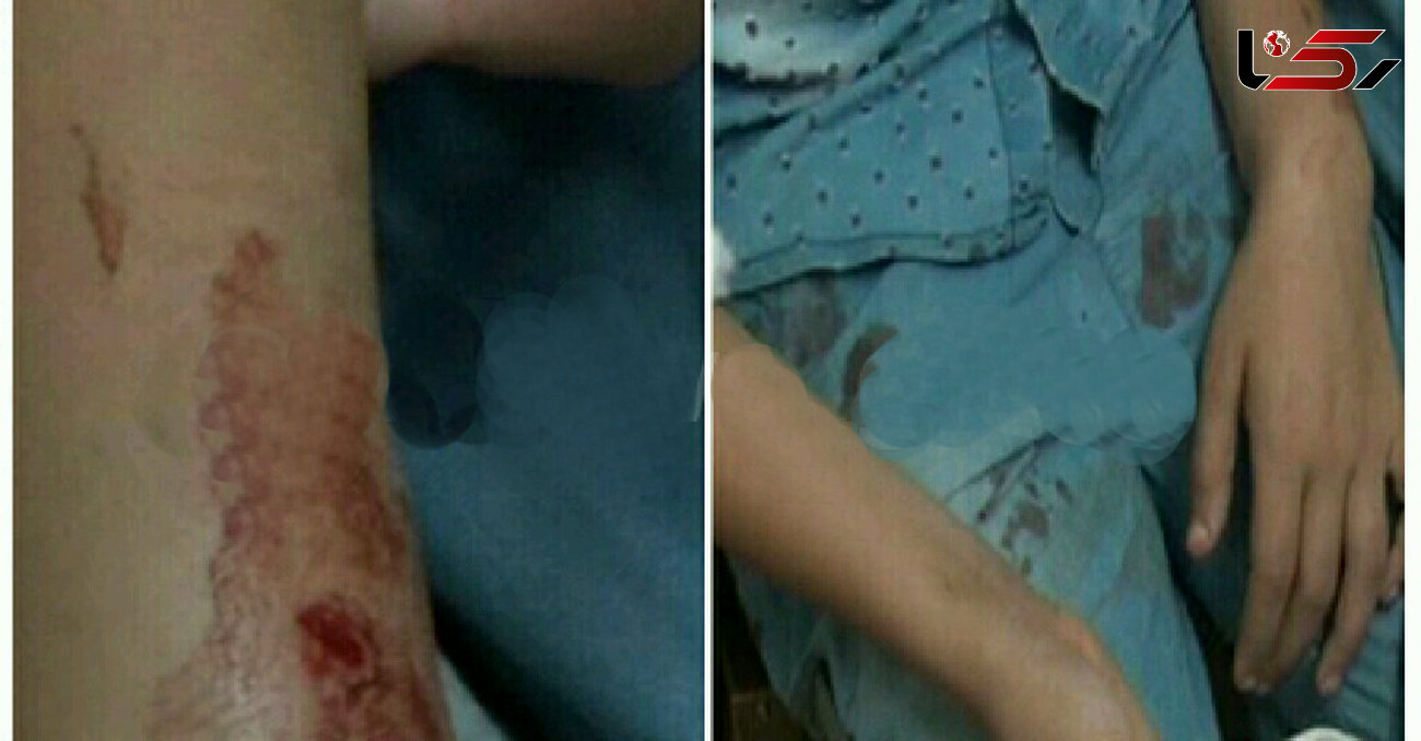 حمله خونین سگ های ولگرد به مردم در آستانه اشرفیه + عکس