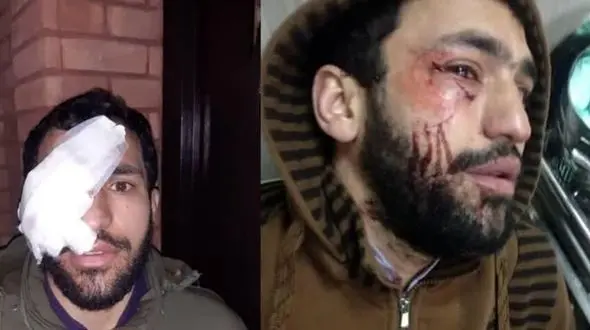 آخرین وضعیت روحانی که مقابل مزاحم یک خانم ایستاد / چاقوکش مست فرار کرد + عکس