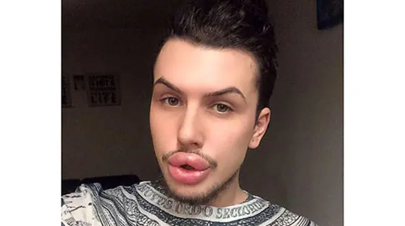 تصاویر مضحک پسرانی که با جراحی خود را شبیه کیم کارداشیان کردند+عکس