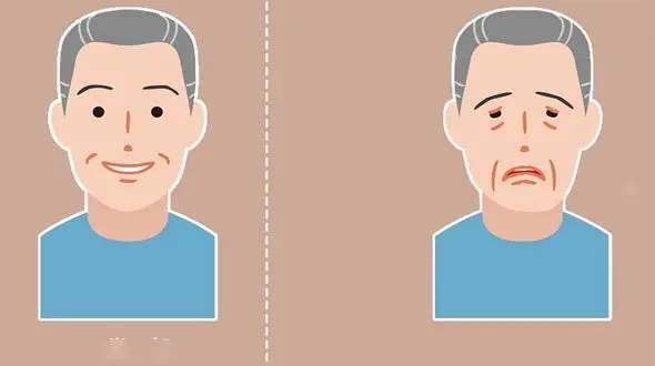 میاستنی گراویس چیست؟ / این افتادگی چشم را جدی بگیرید + فیلم