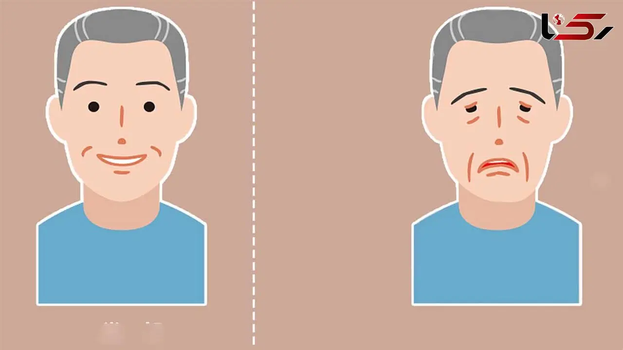 میاستنی گراویس چیست؟ / این افتادگی چشم را جدی بگیرید + فیلم